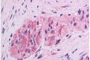 Immunohistochemistry (Formalin-fixed Paraffin-embedded Sections) (IHC (fp)) image for anti-Wingless-Type MMTV Integration Site Family, Member 5A (WNT5A) (AA 180-229) antibody (ABIN574490)