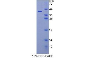 SDS-PAGE analysis of Human UBAP1 Protein.
