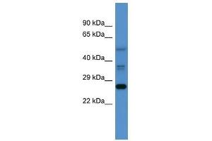 Western Blot showing Commd2 antibody used at a concentration of 1-2 ug/ml to detect its target protein. (COMMD2 抗体  (Middle Region))