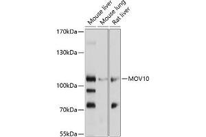 Western blot analysis of extracts of various cell lines, using MOV10 antibody (ABIN1680885, ABIN3018353, ABIN3018354 and ABIN6220441) at 1:1000 dilution. (MOV10 抗体  (AA 1-310))