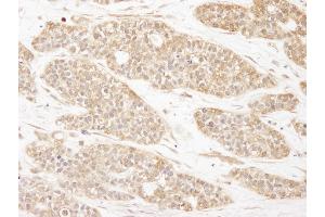 Immunohistochemistry (IHC) image for anti-Coiled-Coil and C2 Domain Containing 1A (CC2D1A) (AA 1-50) antibody (ABIN7448937)