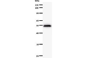 Western Blotting (WB) image for anti-Protein Phosphatase 1, Regulatory Subunit 13 Like (PPP1R13L) antibody (ABIN931102) (PPP1R13L 抗体)