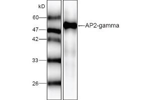 Western blot analysis of recombinant AP2 gamma, using AP2 gamma antibody (1/1000 dilution). (TFAP2C 抗体)