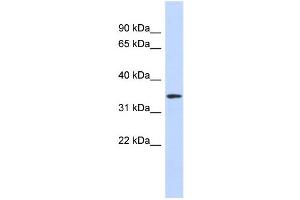 WB Suggested Anti-OR13C5 Antibody Titration:  0. (OR13C5 抗体  (N-Term))