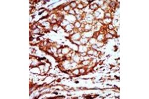 Image no. 2 for anti-14-3-3 alpha + beta (YWHAB) (C-Term) antibody (ABIN360672) (YWHAB 抗体  (C-Term))