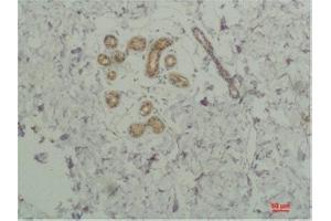 Immunohistochemistry (IHC) analysis of paraffin-embedded Human SkinTissue using STAT2 Rabbit Polyclonal Antibody diluted at 1:200. (STAT2 抗体)