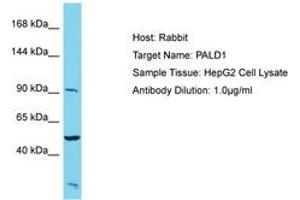 Image no. 1 for anti-Phosphatase Domain Containing, Paladin 1 (PALD1) (AA 143-192) antibody (ABIN6750572) (KIAA1274 抗体  (AA 143-192))