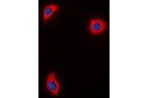 Immunofluorescent analysis of AKAP1 staining in HuvEc  cells. (AKAP1 抗体)
