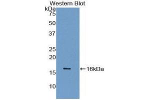 Western Blotting (WB) image for anti-Synuclein, gamma (Breast Cancer-Specific Protein 1) (SNCG) (AA 1-115) antibody (ABIN1078560) (SNCG 抗体  (AA 1-115))