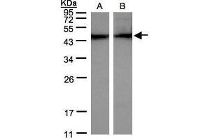 Western Blotting (WB) image for anti-Actin, Alpha, Cardiac Muscle 1 (ACTC1) antibody (ABIN2855212)