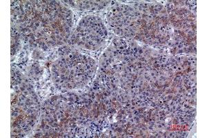 Immunohistochemistry (IHC) analysis of paraffin-embedded Human Lung, antibody was diluted at 1:100. (LILRA1 抗体  (N-Term))