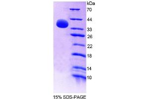 SDS-PAGE analysis of Human GBP4 Protein. (GBP4 蛋白)