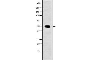 Western blot analysis of ACTL6B using HeLa whole cell lysates (Actin-Like 6B 抗体  (Internal Region))