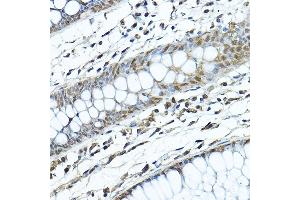Immunohistochemistry of paraffin-embedded human colon using [KO Validated] SIRT1 Rabbit pAb (ABIN6129328, ABIN6147784, ABIN6147785 and ABIN6215138) at dilution of 1:200 (40x lens). (SIRT1 抗体  (AA 448-747))
