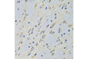 Immunohistochemistry of paraffin-embedded mouse brain using DARS antibody. (DARS 抗体  (AA 222-501))