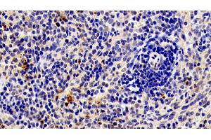 Immunohistochemistry (IHC) image for anti-Matrix Metallopeptidase 9 (Gelatinase B, 92kDa Gelatinase, 92kDa Type IV Collagenase) (MMP9) (AA 225-390) antibody (APC) (ABIN7443959)