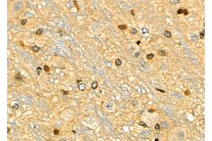 ABIN6259156 and ABIN6275313 at 1/100 staining Rat brain tissue by IHC-P. (PPP1R8 抗体  (Internal Region))