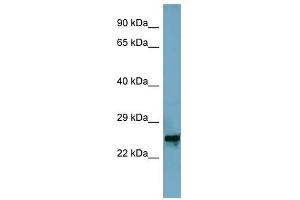 MRPL48 antibody used at 1 ug/ml to detect target protein. (MRPL48 抗体  (Middle Region))