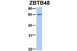 Host:  Rabbit  Target Name:  ZBTB48  Sample Type:  293T  Antibody Dilution:  1. (ZBTB48 抗体  (N-Term))