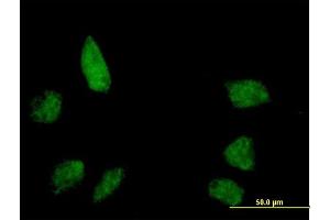 Immunofluorescence of purified MaxPab antibody to BANP on HeLa cell. (BANP 抗体  (AA 1-469))