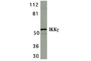 Western Blotting (WB) image for anti-Inhibitor of kappa Light Polypeptide Gene Enhancer in B-Cells, Kinase gamma (IKBKG) (C-Term) antibody (ABIN1030433) (IKBKG 抗体  (C-Term))