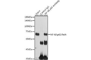 Immunoprecipitation analysis of 300 μg extracts of 293T cells using 3 μg NF-kB p65/RelA antibody (ABIN6134740, ABIN6146862, ABIN6146864 and ABIN6215109).