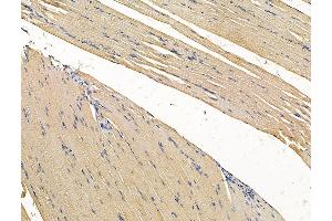 ABIN7096273 and ABIN7100335 at 1/100 staining rat muscle tissue by IHC-P. (VWA5B2 抗体)