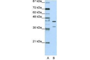 HNRPK antibody used at 1. (HNRNPK 抗体  (C-Term))