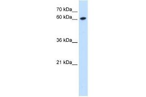Western Blot showing ZNF169 antibody used at a concentration of 0. (ZNF169 抗体  (Middle Region))