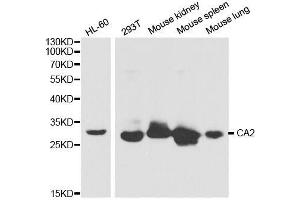 Western blot analysis of extracts of various cell lines, using CA2 antibody. (CA2 抗体  (AA 1-250))