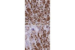 Immunohistochemical staining of human stomach with KCNG1 polyclonal antibody  shows strong cytoplasmic positivity in glandular cells. (KCNG1 抗体)