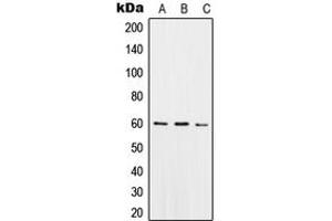 Western blot analysis of SNX4 expression in THP1 (A), Raw264.