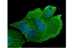 ICC/IF analysis of CD29 in HepG2 cells line, stained with DAPI (Blue) for nucleus staining and monoclonal anti-human CD29 antibody (1:100) with goat anti-mouse IgG-Alexa fluor 488 conjugate (Green).