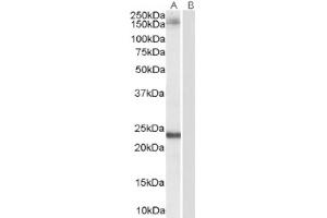 Image no. 1 for anti-Golgin A3 (GOLGA3) (C-Term) antibody (ABIN374604) (Golgin A3 抗体  (C-Term))