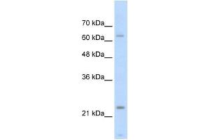 Troponin I Type 1 antibody used at 2. (TNNI1 抗体)