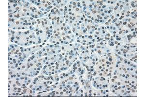 Immunohistochemical staining of paraffin-embedded lung tissue using anti-PLK1mouse monoclonal antibody. (PLK1 抗体)