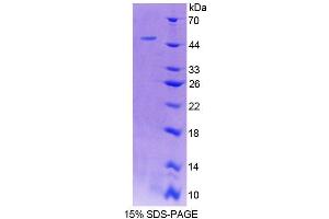 SDS-PAGE (SDS) image for Ladinin 1 (LAD1) (AA 1-140) protein (His tag,GST tag) (ABIN4989353) (Ladinin 1 Protein (LAD1) (AA 1-140) (His tag,GST tag))