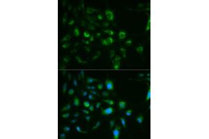 Immunofluorescence analysis of MCF7 cell using TLR8 antibody. (TLR8 抗体)