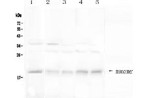 Western blot analysis of BAFF Receptor using anti-BAFF Receptor antibody . (TNFRSF13C 抗体  (AA 1-78))
