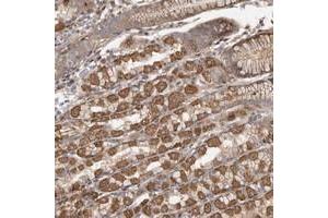 Immunohistochemical staining of human stomach with C9orf128 polyclonal antibody  shows distinct cytoplasmic positivity in parietal cells at 1:200-1:500 dilution. (FAM221B 抗体)