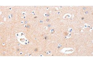 Immunohistochemistry of paraffin-embedded Human brain using B3GAT1 Polyclonal Antibody at dilution of 1:40 (CD57 抗体)
