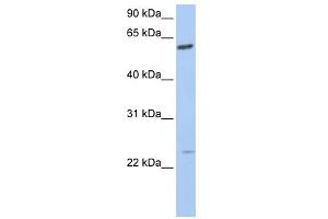 WB Suggested Anti-FAM3C Antibody Titration:  0. (FAM3C 抗体  (C-Term))