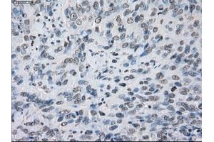 Immunohistochemical staining of paraffin-embedded colon tissue using anti-KDM4C mouse monoclonal antibody. (KDM4C 抗体)