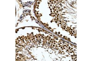 Immunohistochemistry of paraffin-embedded rat testis using ZNF384 Rabbit pAb (ABIN7271478) at dilution of 1:100 (40x lens). (ZNF384 抗体  (AA 1-180))