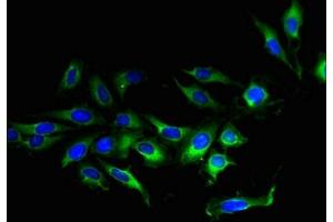 Immunofluorescent analysis of Hela cells using ABIN7173135 at dilution of 1:100 and Alexa Fluor 488-congugated AffiniPure Goat Anti-Rabbit IgG(H+L) (TMEM27 抗体  (AA 73-146))