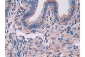 DAB staining on IHC-P; Samples: Mouse Uterus Tissue (LGALS3BP 抗体  (AA 19-577))