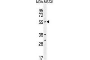 Western blot analysis in MDA-MB231 cell line lysates (35ug/lane) using CYP2A7  Antibody . (CYP2A7 抗体  (Middle Region))