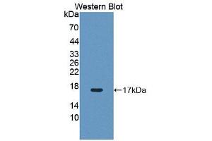 Western blot analysis of the recombinant protein. (PIM1 抗体  (AA 38-177))