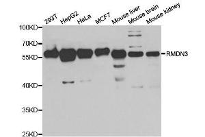 Western blot analysis of extracts of various cell lines, using RMDN3 antibody. (RMDN3 抗体  (AA 171-470))