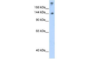 SF3B1 antibody used at 1. (SF3B1 抗体  (N-Term))